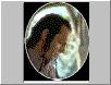 Elrond heals Frodo
